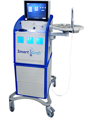 Transplantace vlasů SmartGraft
